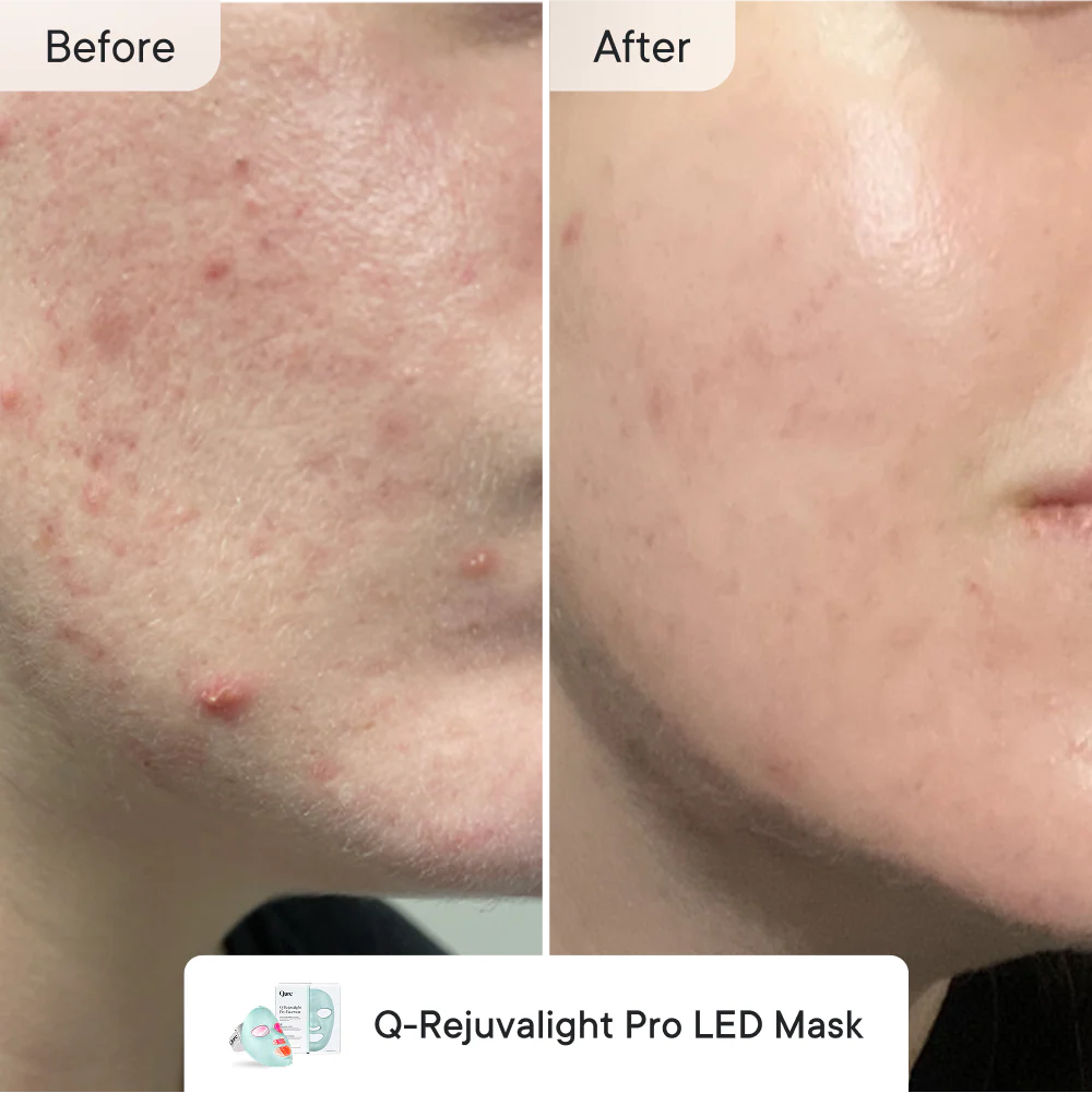 Breakout Control  Advanced - Image 3