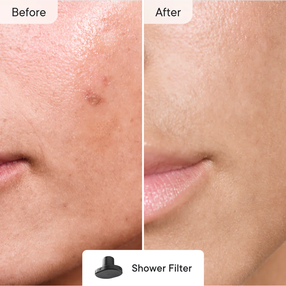 Breakout Control Pro - Image 8