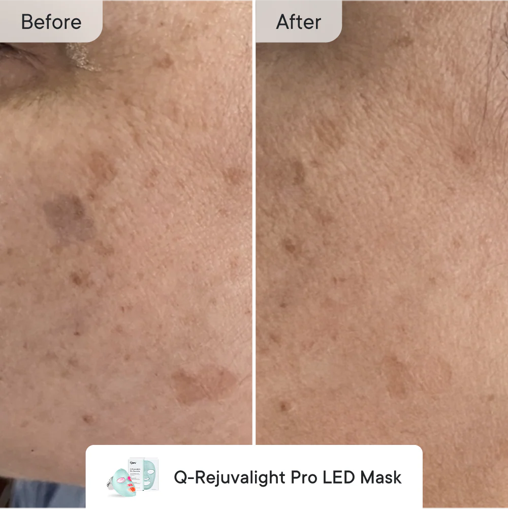 Fade & Firm Bundle Advanced - Image 4