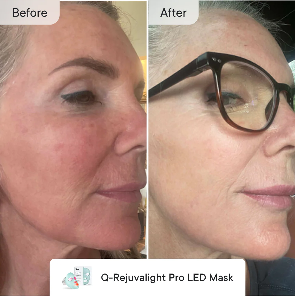 Fade & Firm  Bundle Essential - Image 4