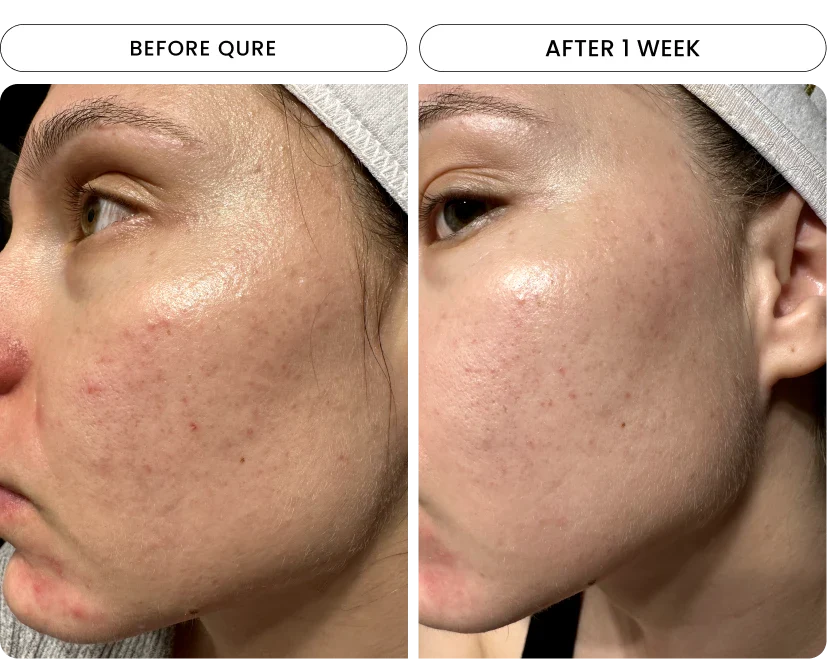 Faucet Filter Refill - Image 7