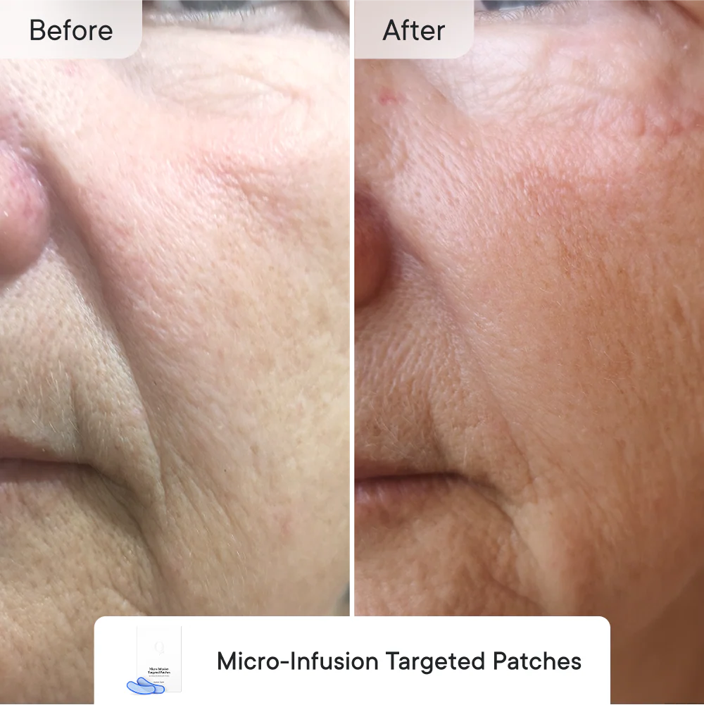 Line Refine Bundle Essential - Image 3