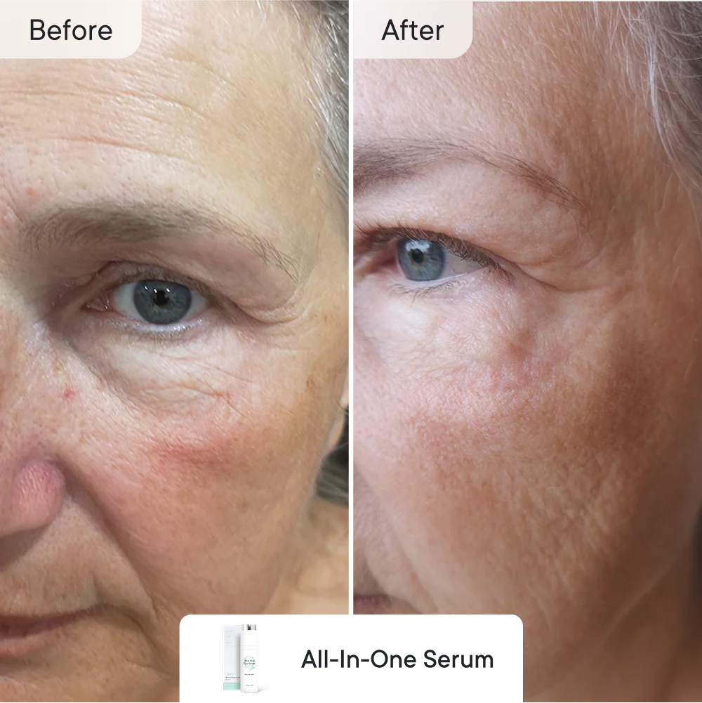 Line Refine Bundle Essential - Image 5