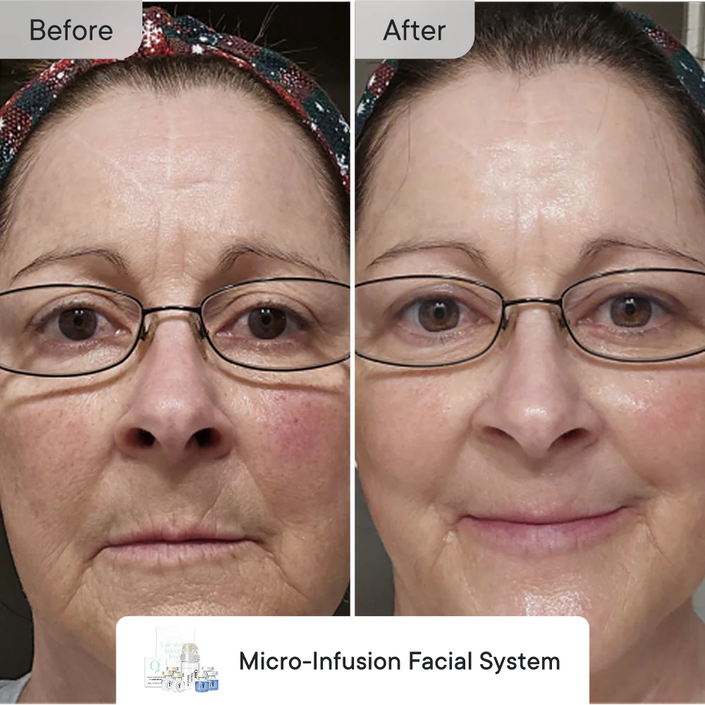 Line Refine Bundle Essential - Image 7