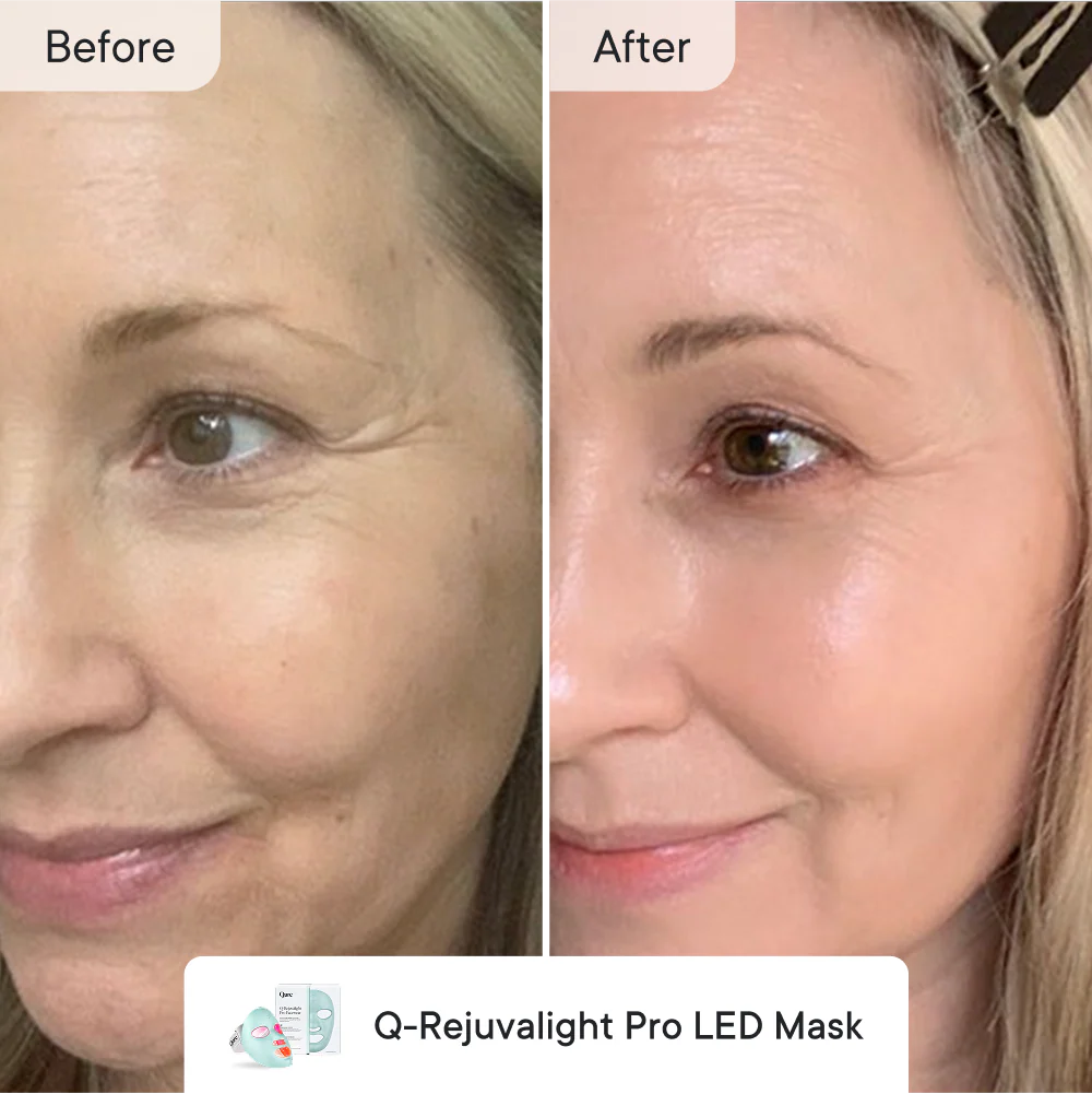 Line Refine Bundle Pro - Image 4