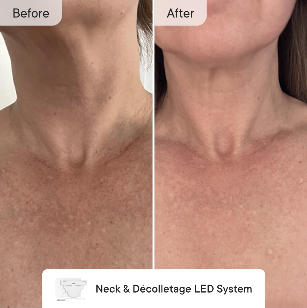 Line Refine Bundle Pro - Image 5