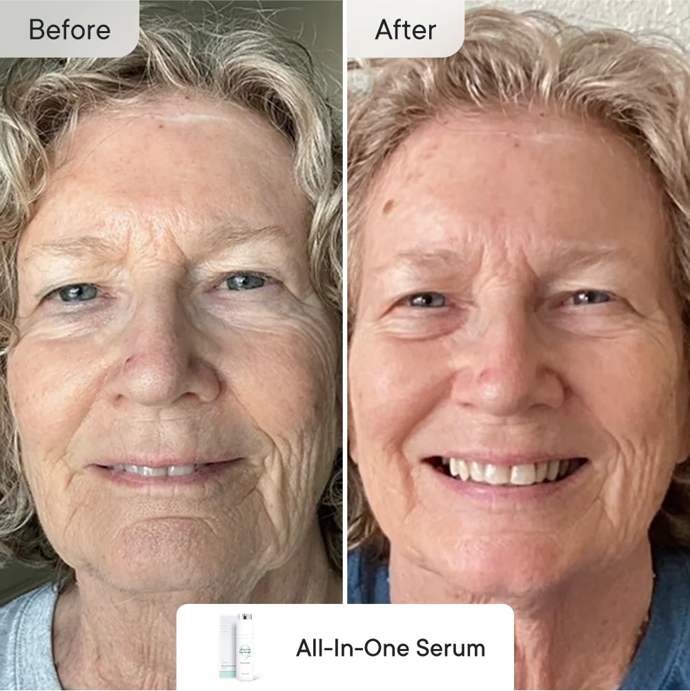 Line Refine Bundle Pro - Image 8