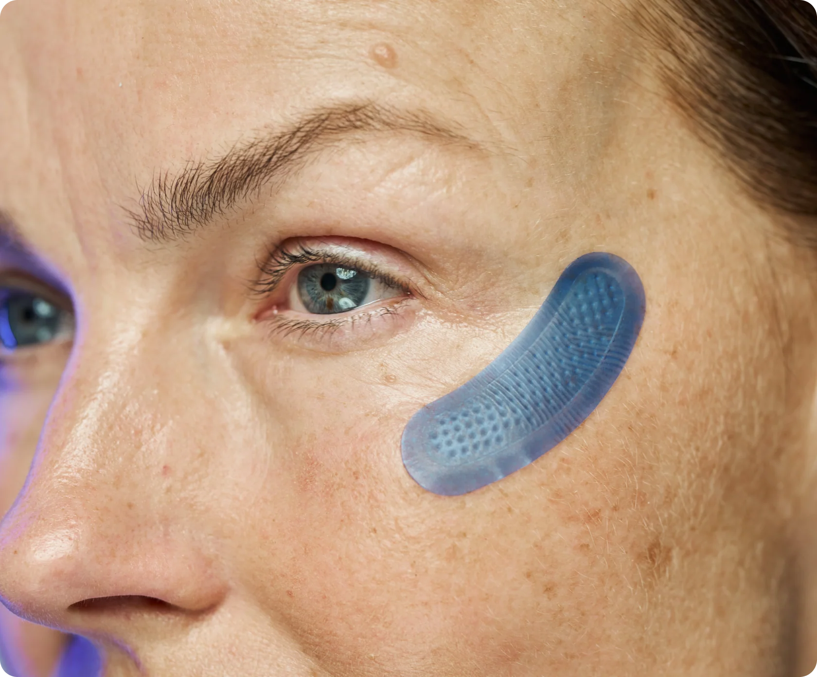 Micro-Infusion Targeted Patches (8 Pairs) - Image 6