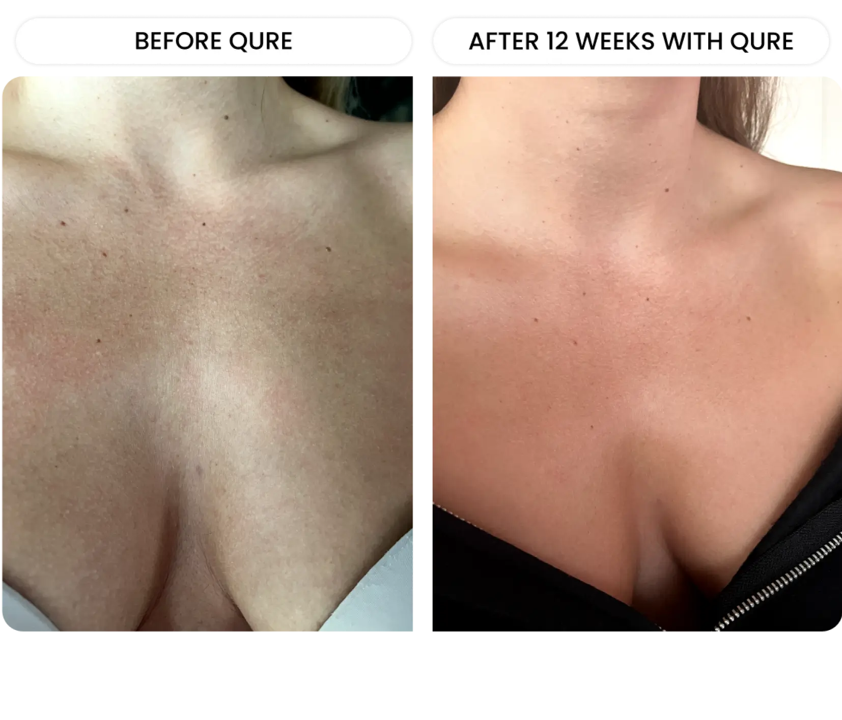 Neck & Décolletage System - Image 10