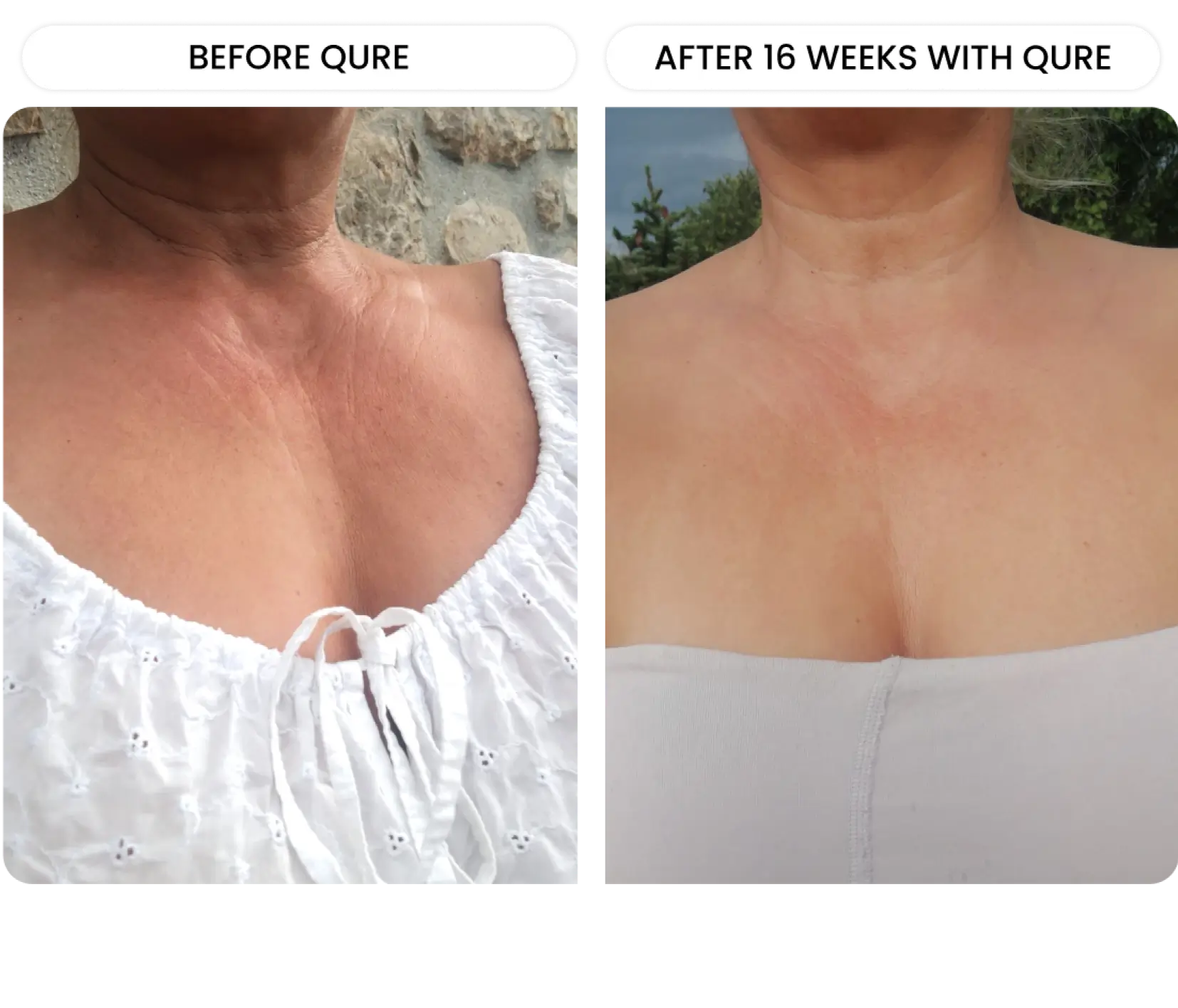 Neck & Décolletage System - Image 9