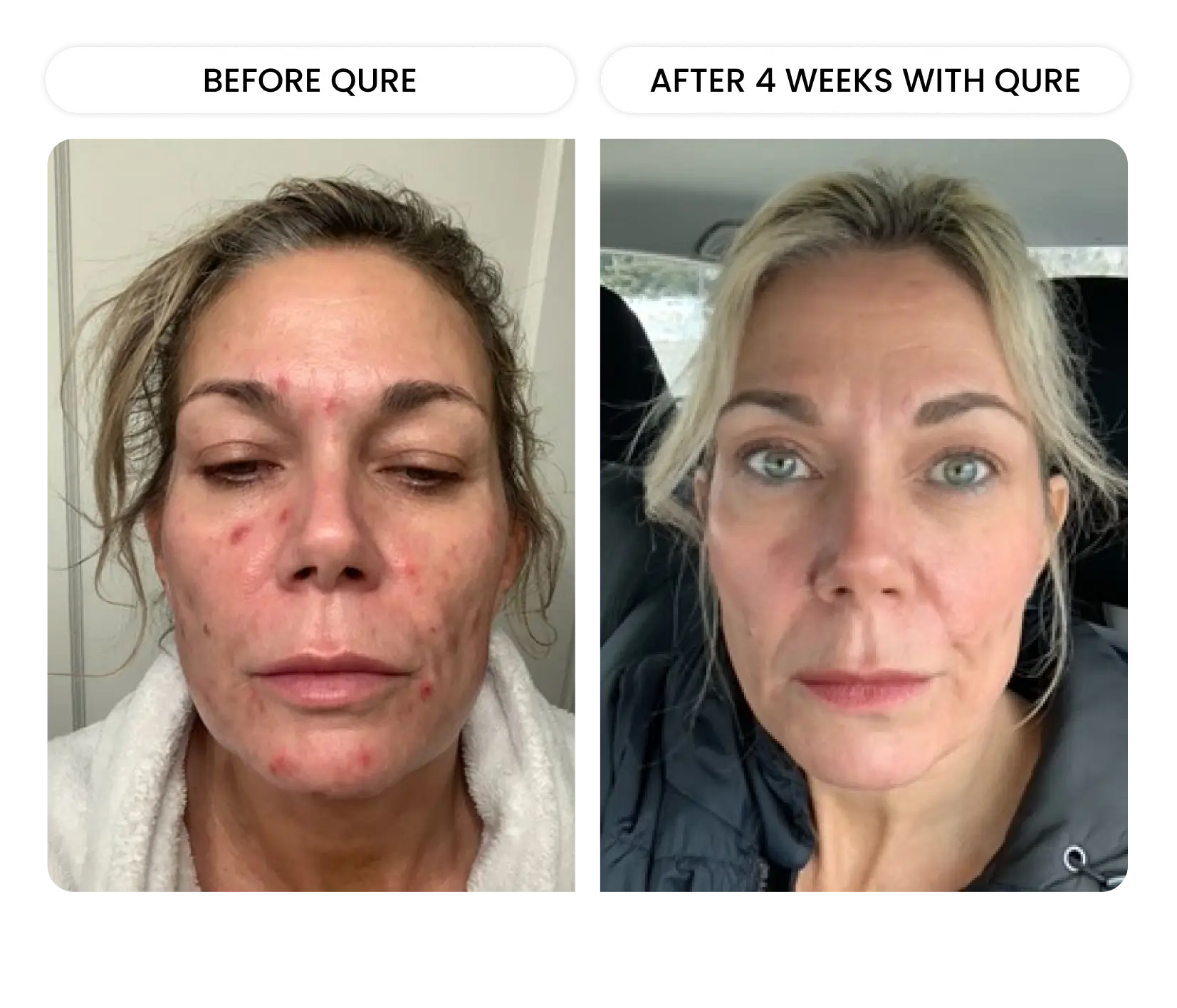 Q-Rejuvalight Pro Facewear - Image 11