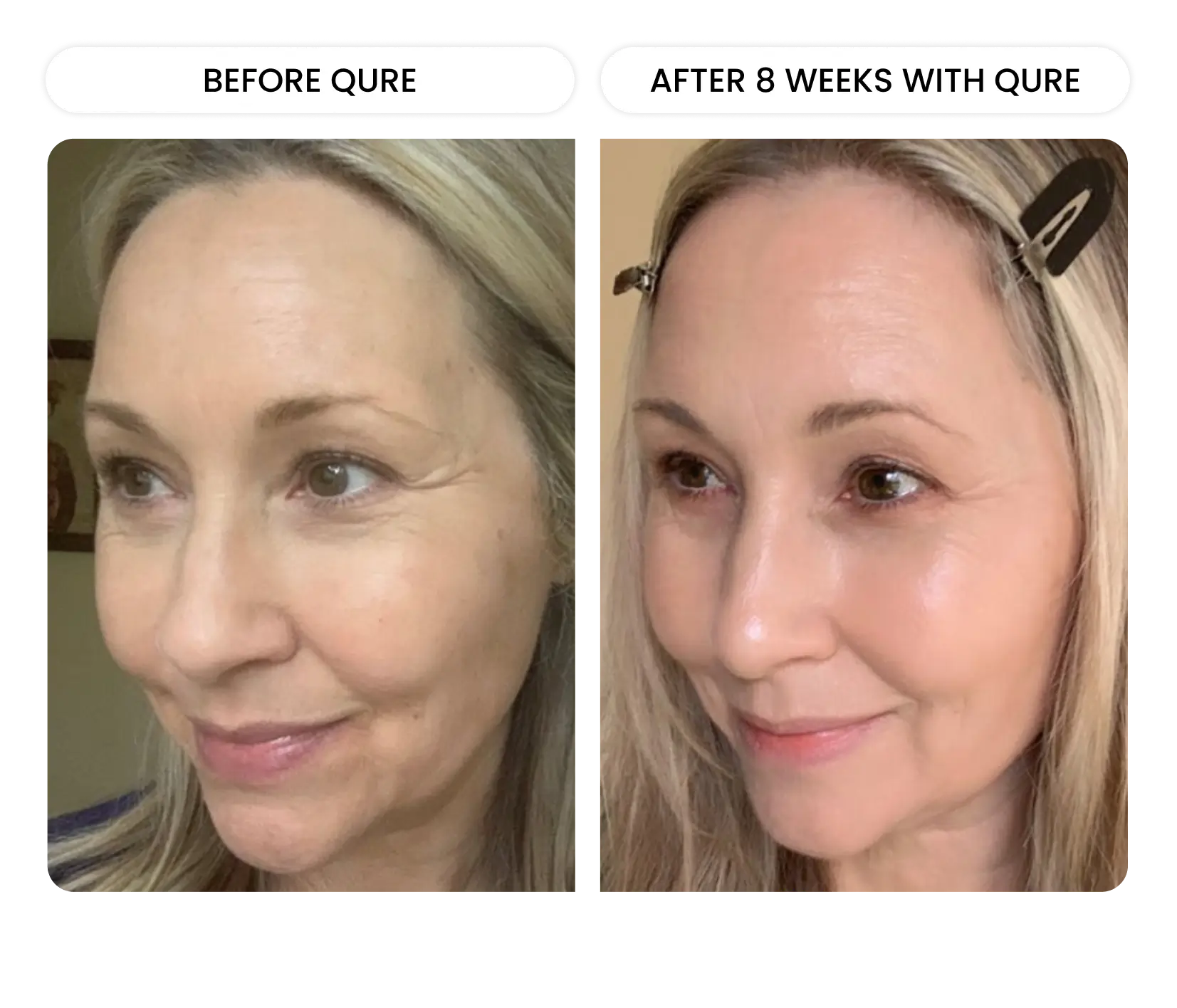 Q-Rejuvalight Pro Facewear - Image 10